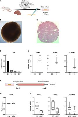 Improved Precision-Cut Liver Slice Cultures for Testing Drug-Induced Liver Fibrosis